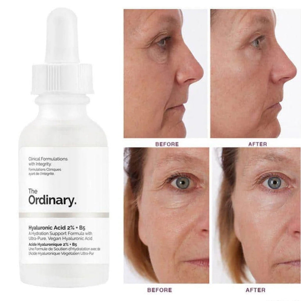 The Ordinary Hyaluronic Acid with 2% + B5 30mL The Ordinary