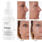 The Ordinary Hyaluronic Acid with 2% + B5 30mL The Ordinary