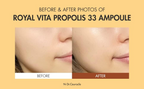 close-up of cheeks before and after using Dr.Ceuracle Royal Vita Propolis 33 Ampoule