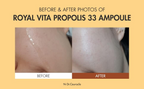 before and after comparision of Dr.Ceuracle Royal Vita Propolis 33 Ampoule