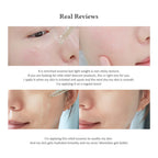 Dr. Althea Skin Relief Essence 30 mL Dr. Althea