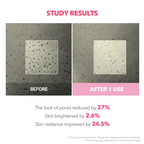 before and after comparision of pores  reduction on the skin.