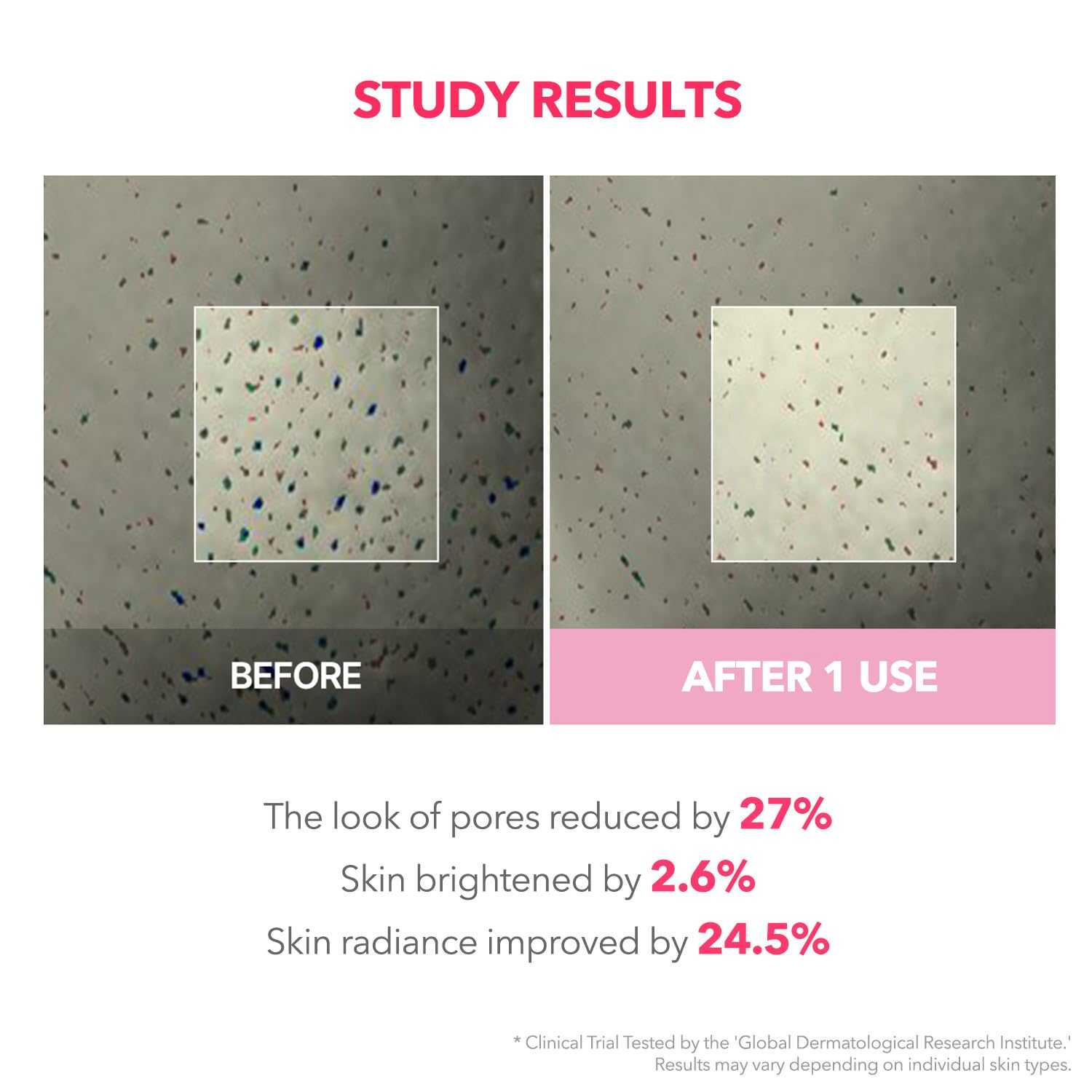 before and after comparision of pores  reduction on the skin.