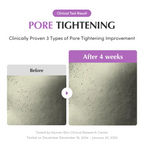 before and after 4 weeks comparision of pore tightening