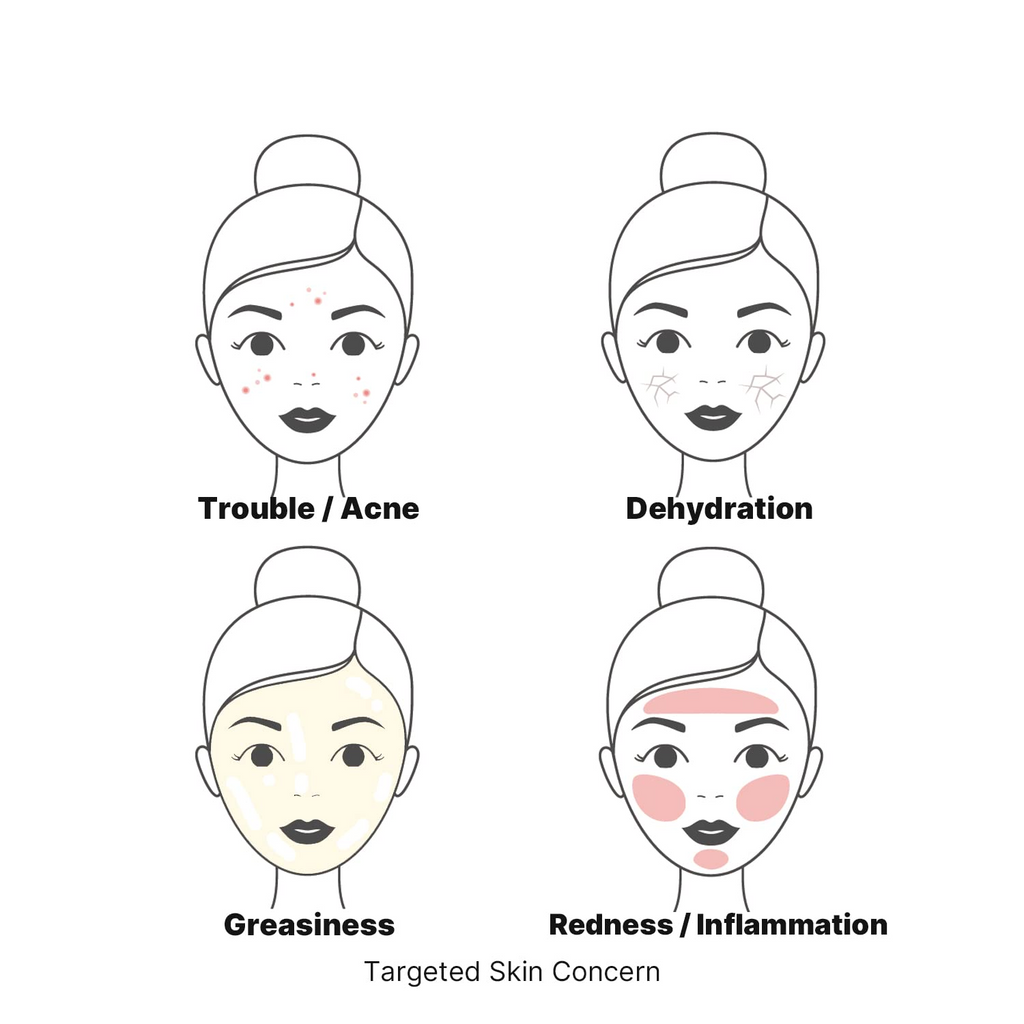 illustrated faces showing targeted concerns: acne, dehyderation, greasiness and redness