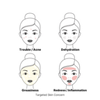 illustrated faces showing targeted concerns: acne, dehyderation, greasiness and redness