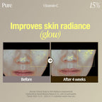 before and after skin radiance comparison