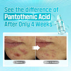 numbuzin No.1 Serum Pantothenic B5 Active Soothing Serum 50 mL / 1.69fl.oz numbuzin