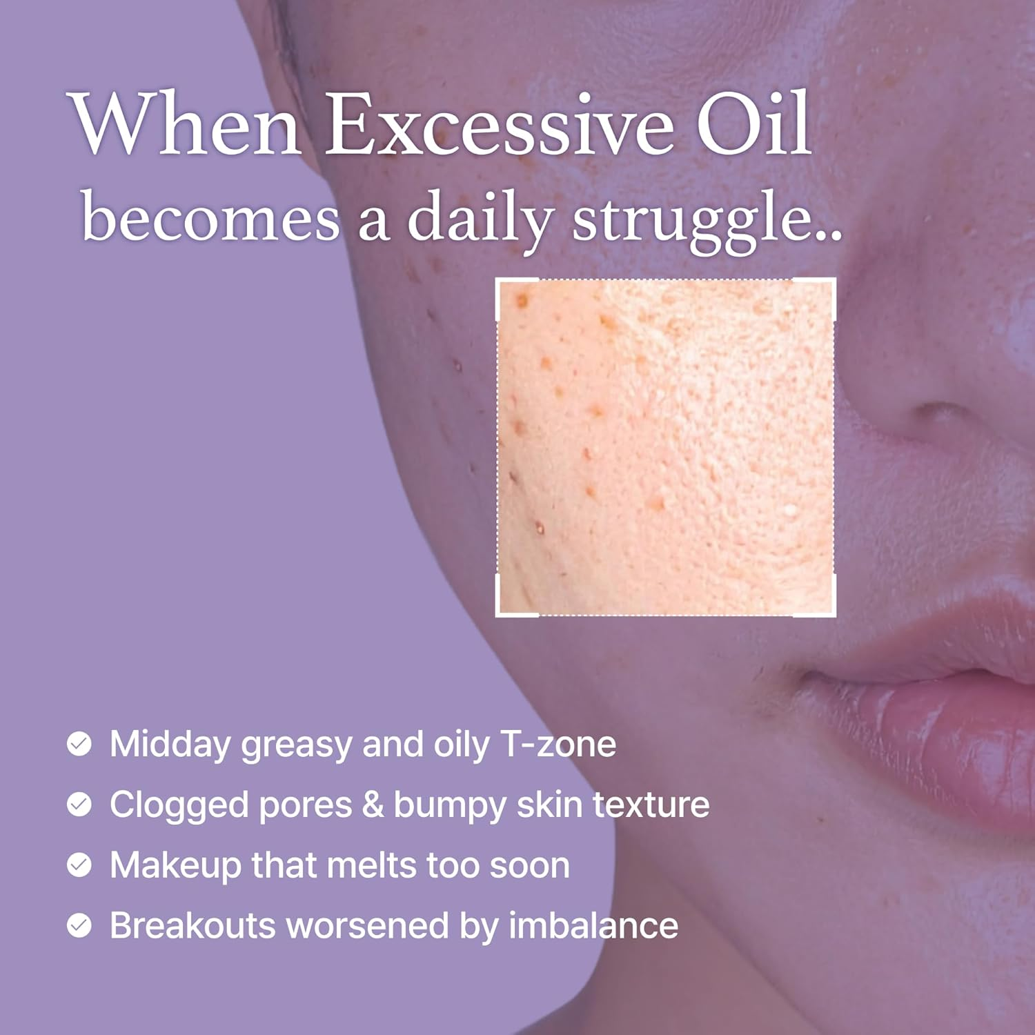 Close-up of skin with text about excessive oil and skin issues.