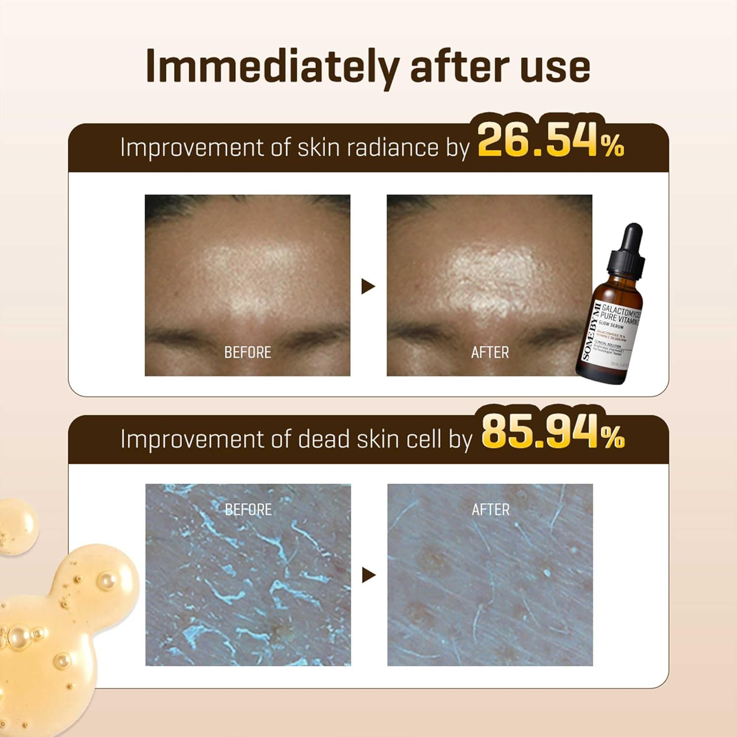 SOME BY MI Galactomyces Pure Vitamin C Glow Serum 30mL SOMEBYMI