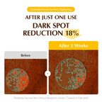 before and after comparision of dark spot reduction