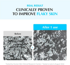 before and after comparision of flaky skin improvement