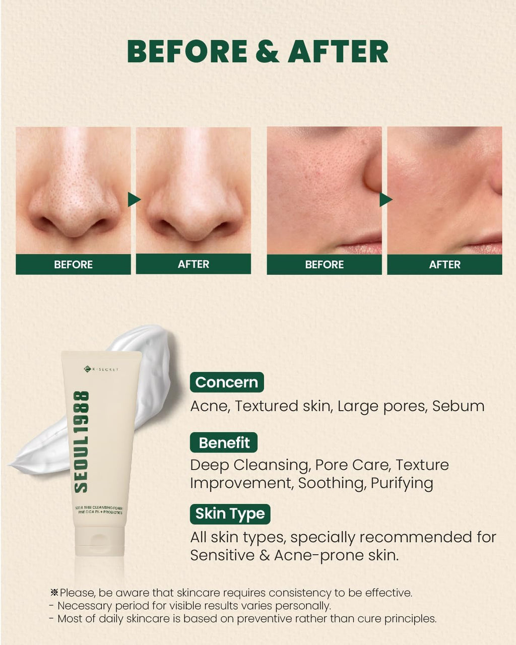 K-SECRET Cleansing Foam, Seoul 1988, Pine Cica 1%, Probiotics, 150ml