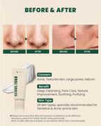 K-SECRET Cleansing Foam, Seoul 1988, Pine Cica 1%, Probiotics, 150ml