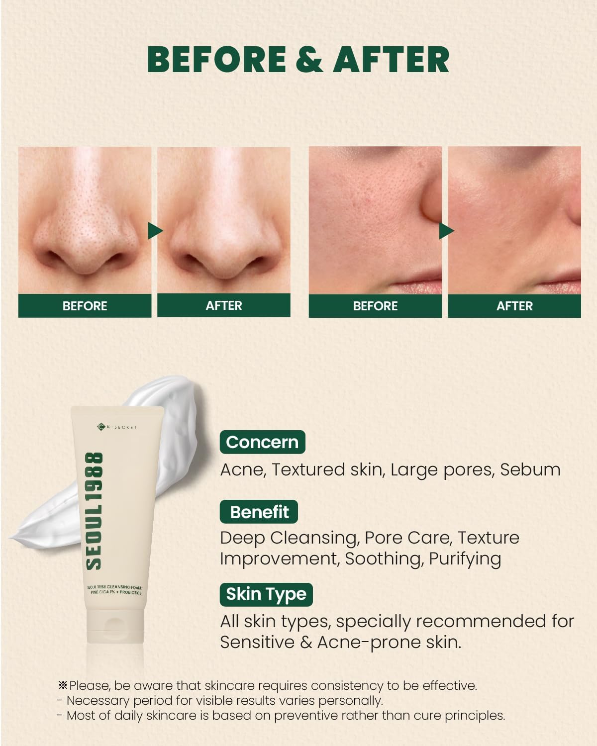 K-SECRET Cleansing Foam, Seoul 1988, Pine Cica 1%, Probiotics, 150ml