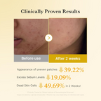 before and after comparison of medicube Kojic Acid Turmeric Pads on skin