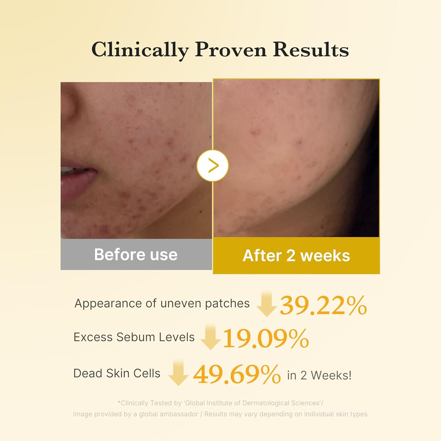 before and after comparison of medicube Kojic Acid Turmeric Pads on skin