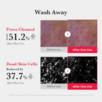 Before and after effects of medicube Red Foam Cleanser on skin pores and dead skin cells 