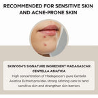close-up of acne-proned skin