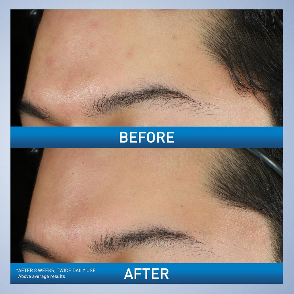 two images of before and after skin comparision 