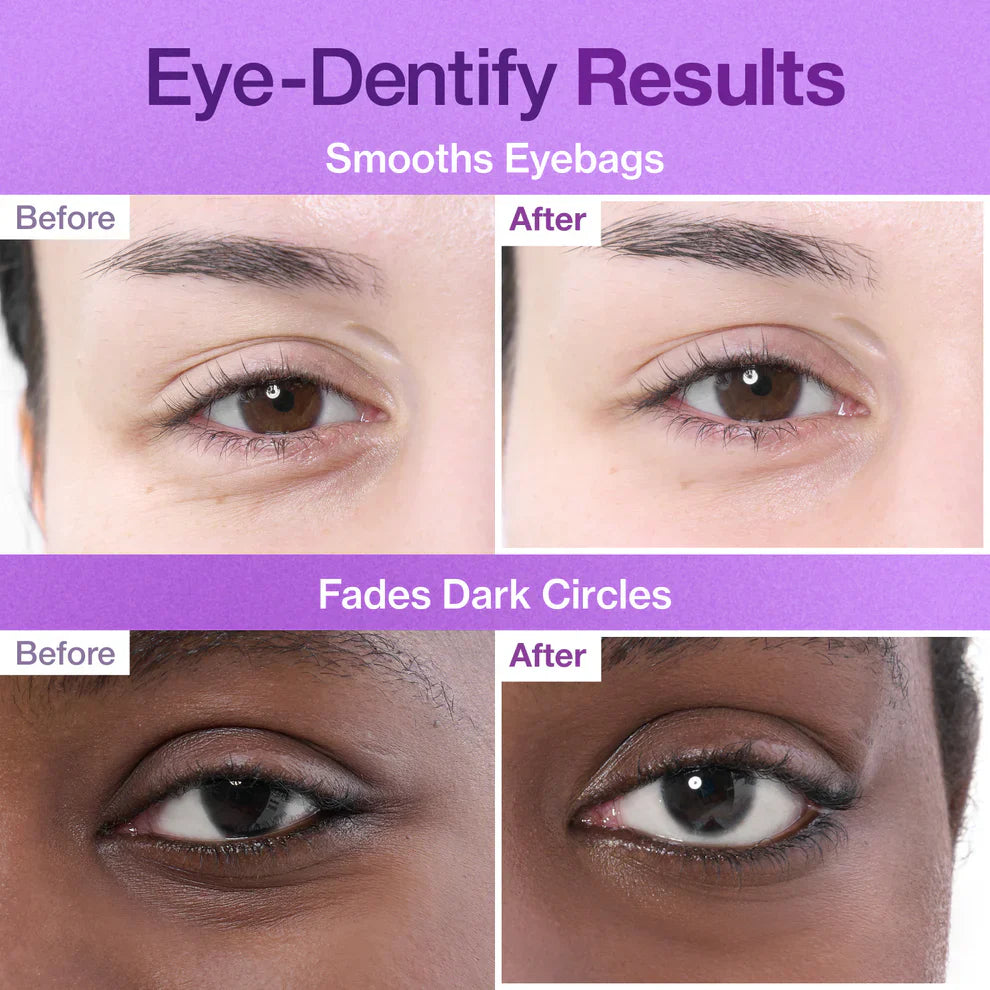 Numbuzin No.9 3 Days Eye Care Kit | Intensive Firming & Wrinkle Care for Eyes