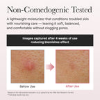 Arencia Red Smoothie Lotion 5 – 200mL | Niacinamide & Collagen Hydrating Lotion | Pore Smoothing & Moisture Care | Korean Skincare UAE