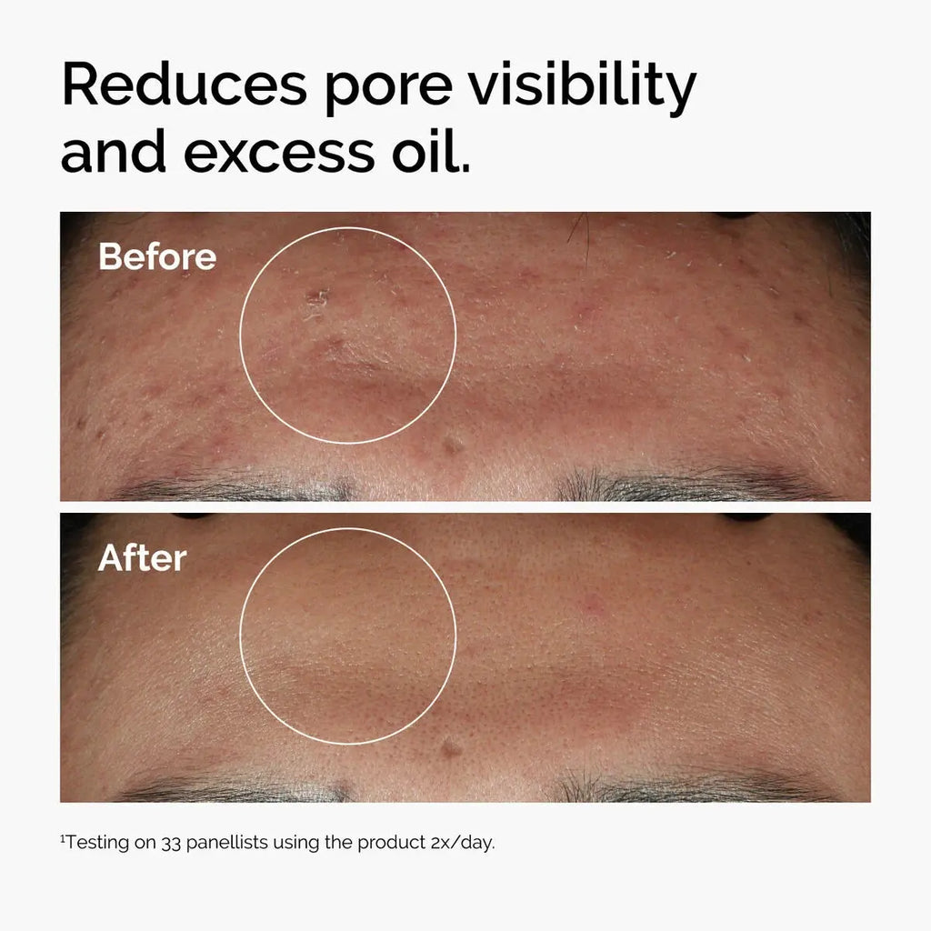 The Ordinary Niacinamide 10% + Zinc 1% Serum, 30 mL The Ordinary